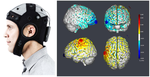 Transcranial direct current stimulation in chronic spinal cord injury: quantitative EEG study